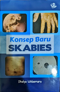 Image of Konsep Baru Skabies